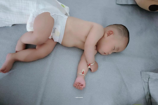 乌海六个月宝宝眼睛散光